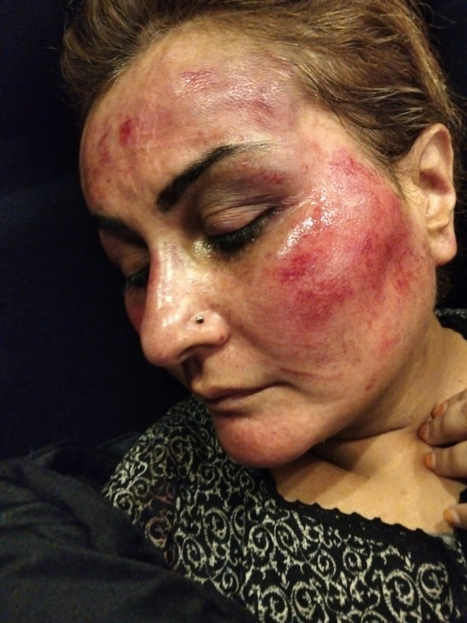 Stage Actress Nargis Allegedly Assaulted by Husband; Chief Minister Takes Notice